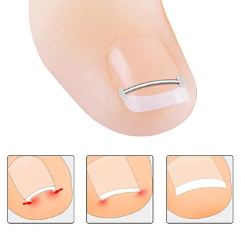 Инструменти за корекция на врастнали нокти на краката За Педикюр За възстановяване на Врастнали нокти на краката Професионално средство за корекция на врастнали нокти на краката